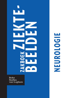 cover image of Zakboek ziektebeelden Neurologie